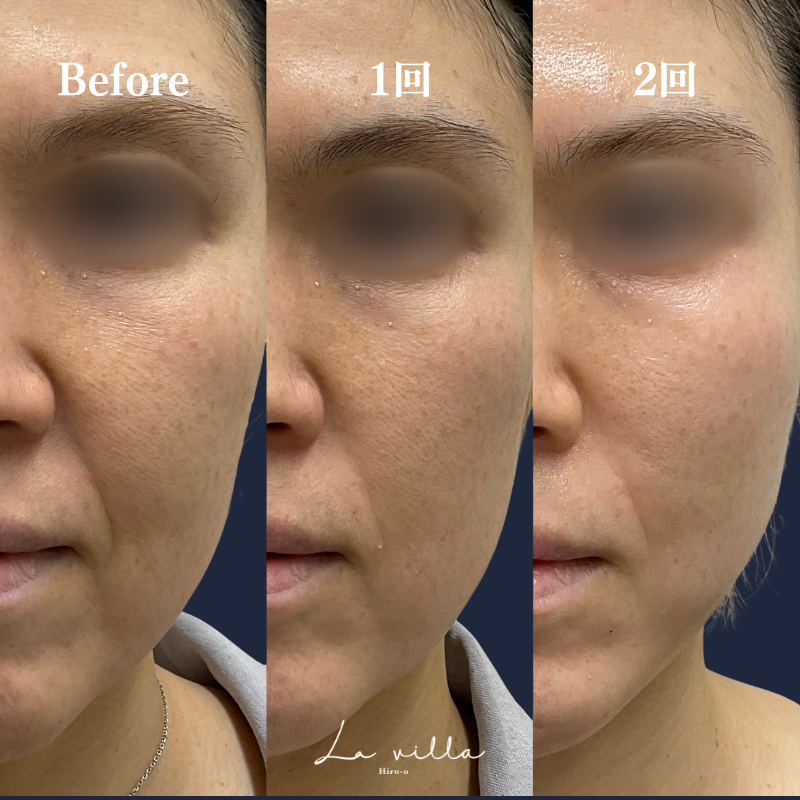 カシミヤスキン No.195