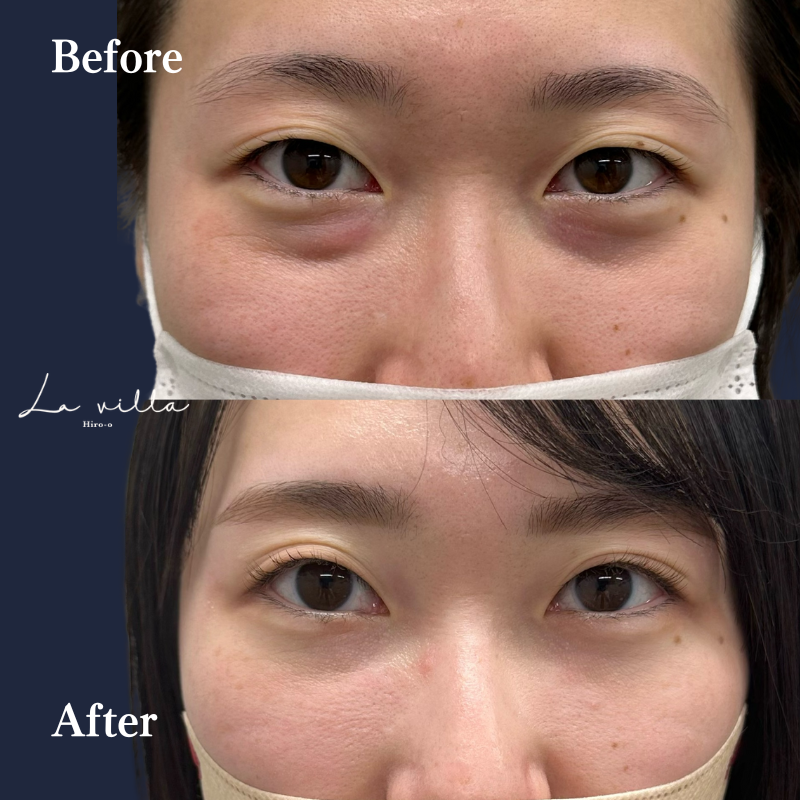 裏ハムラ　No.174