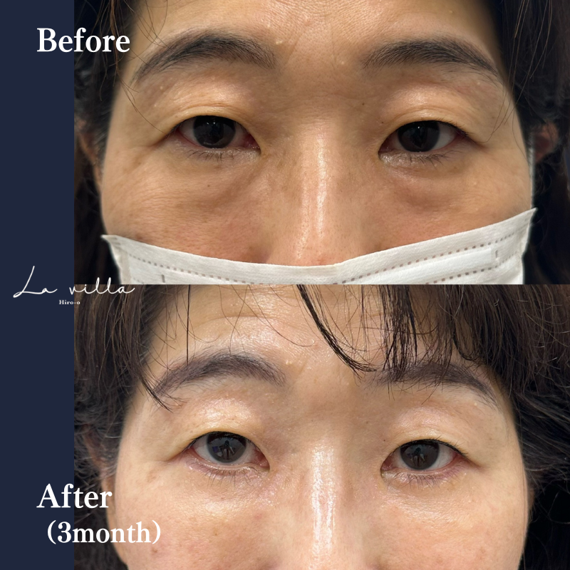 表ハムラ　No.175