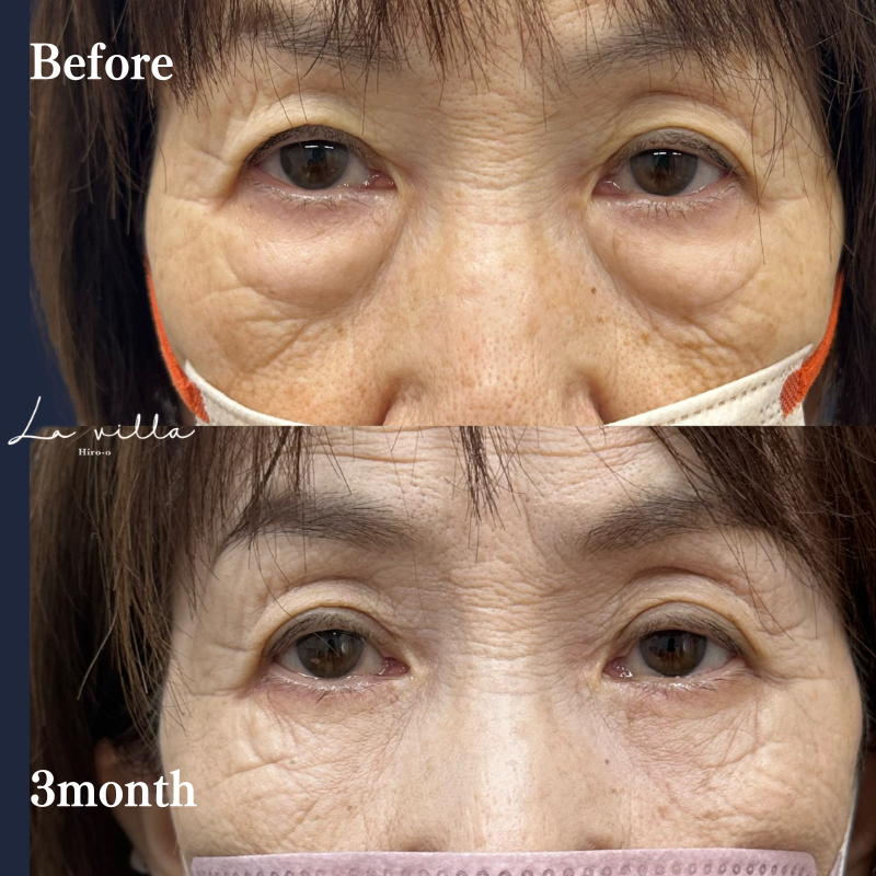 表ハムラ　No.217