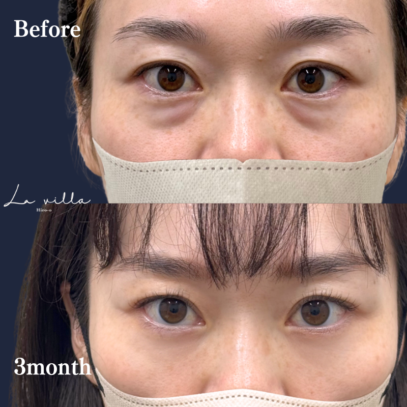 裏ハムラ　No.223