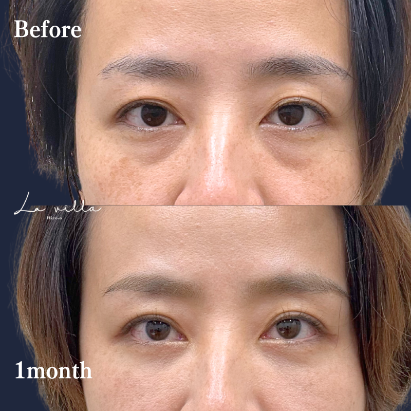 裏ハムラ　No.196