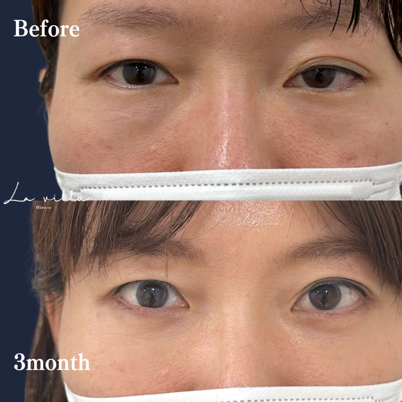 裏ハムラ　No.222