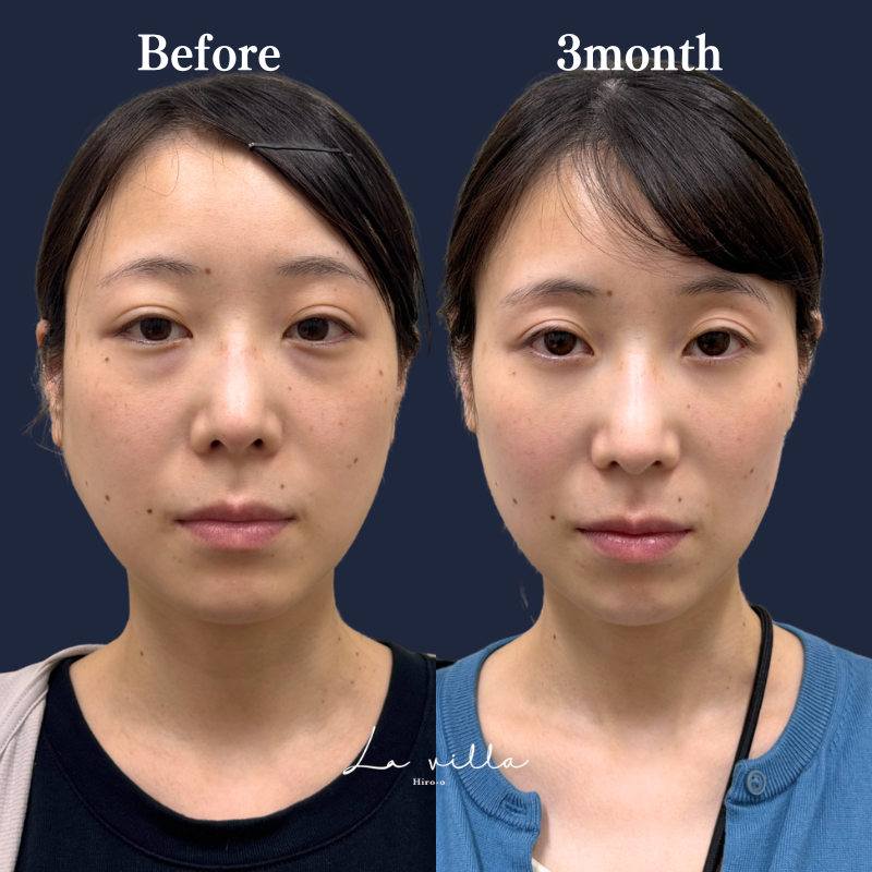 裏ハムラ　No.197