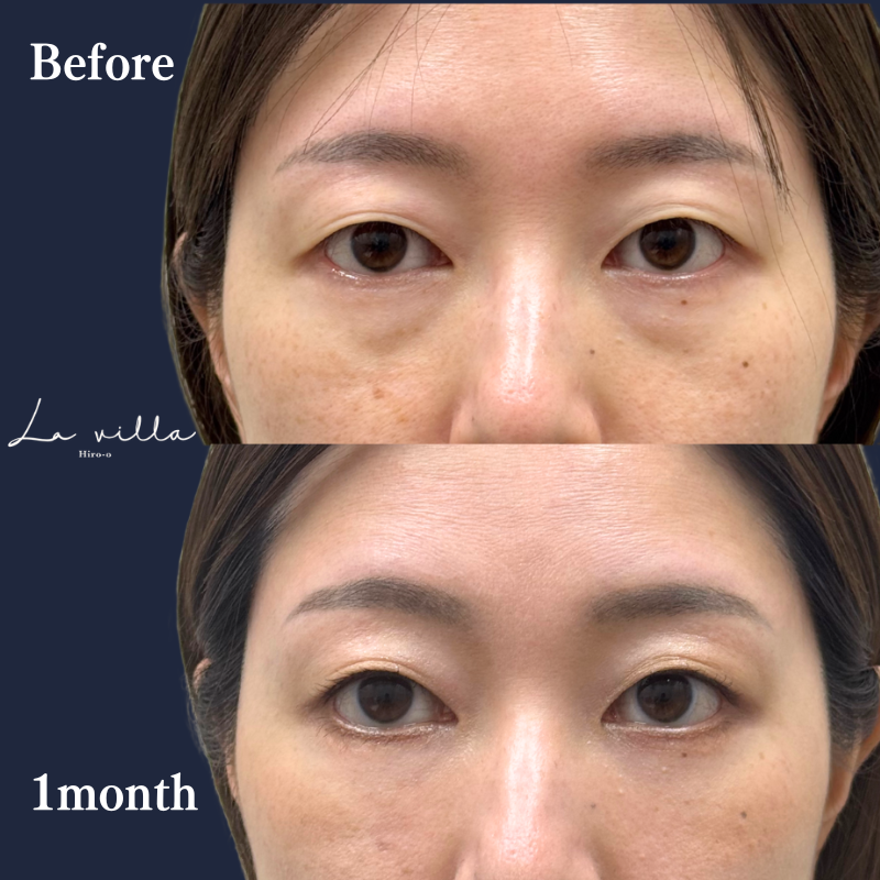 裏ハムラ　No.231