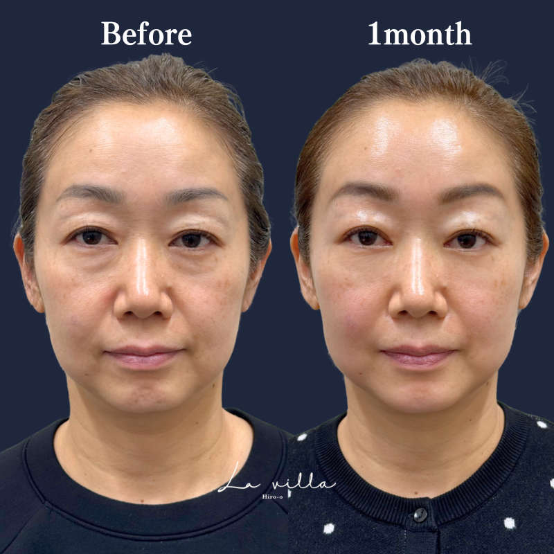 裏ハムラ　No.270