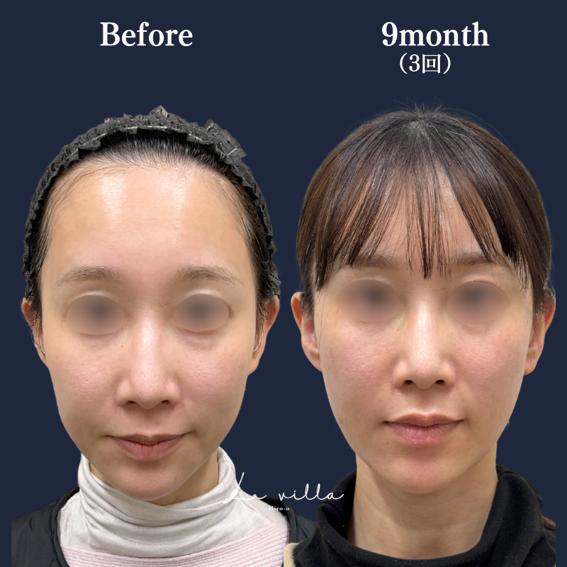 ボルニューマ No.256