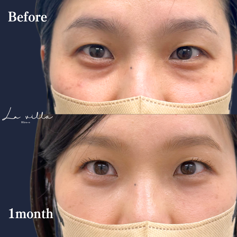 裏ハムラ　No.260