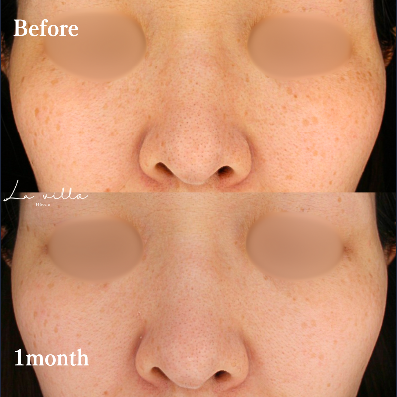 ルビーフラクショナル　No.235