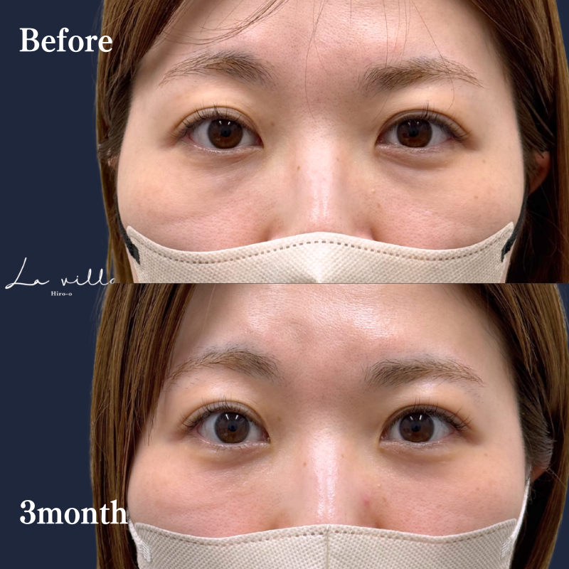 裏ハムラ　No.236