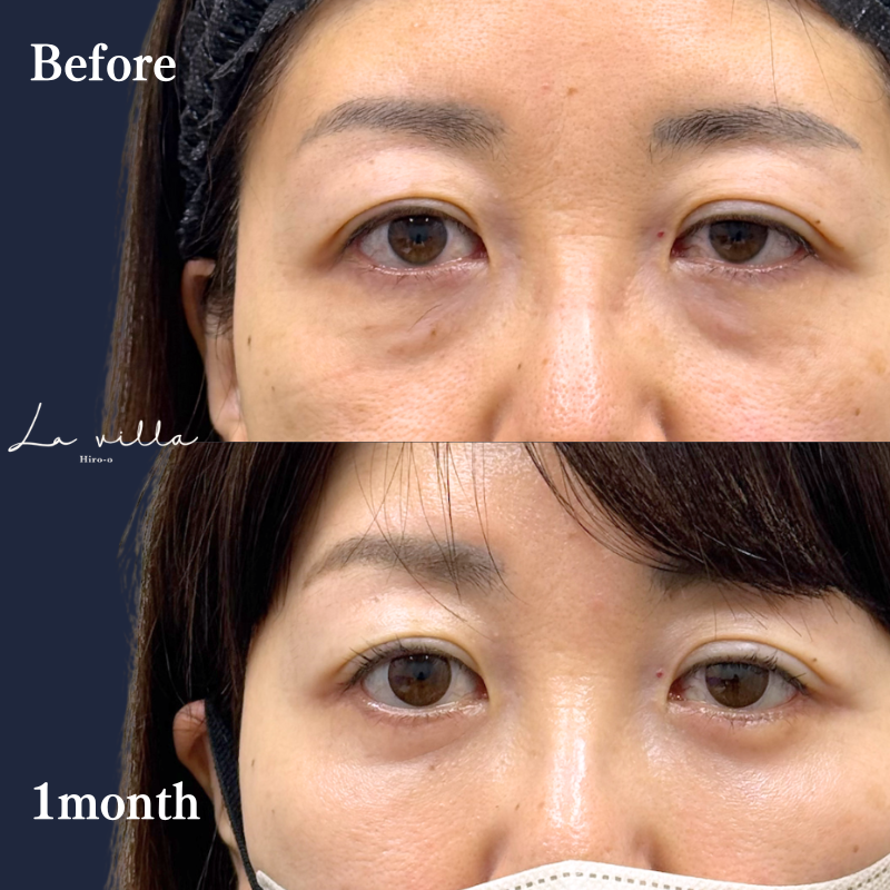 表ハムラ　No.237