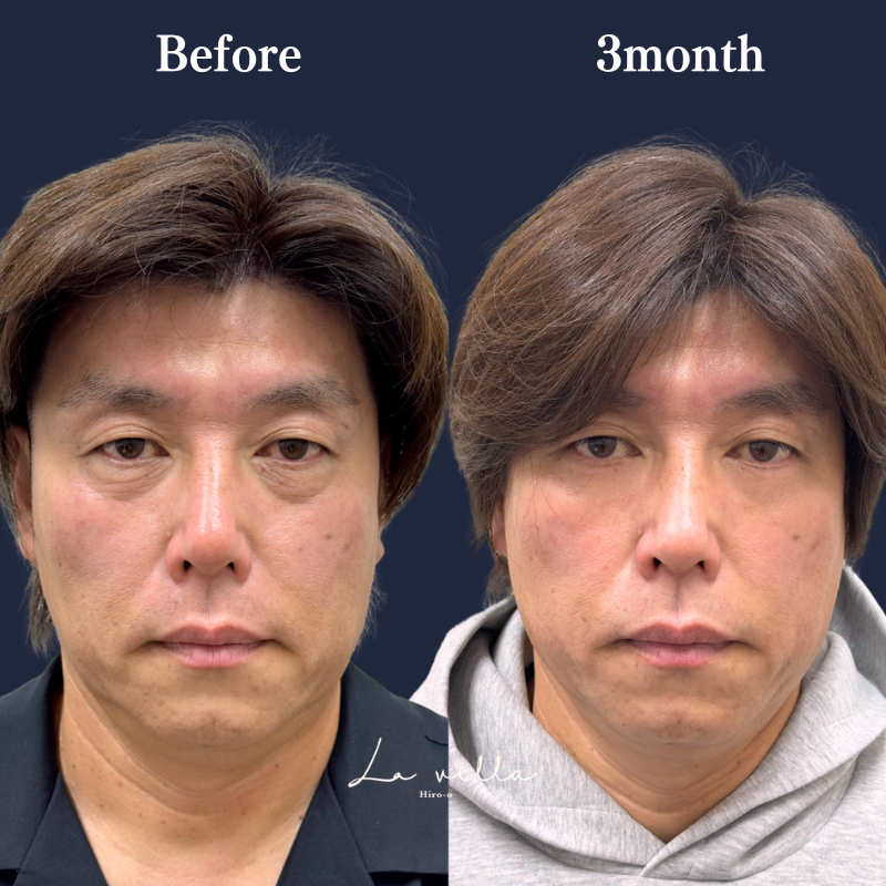 表ハムラ　No.238