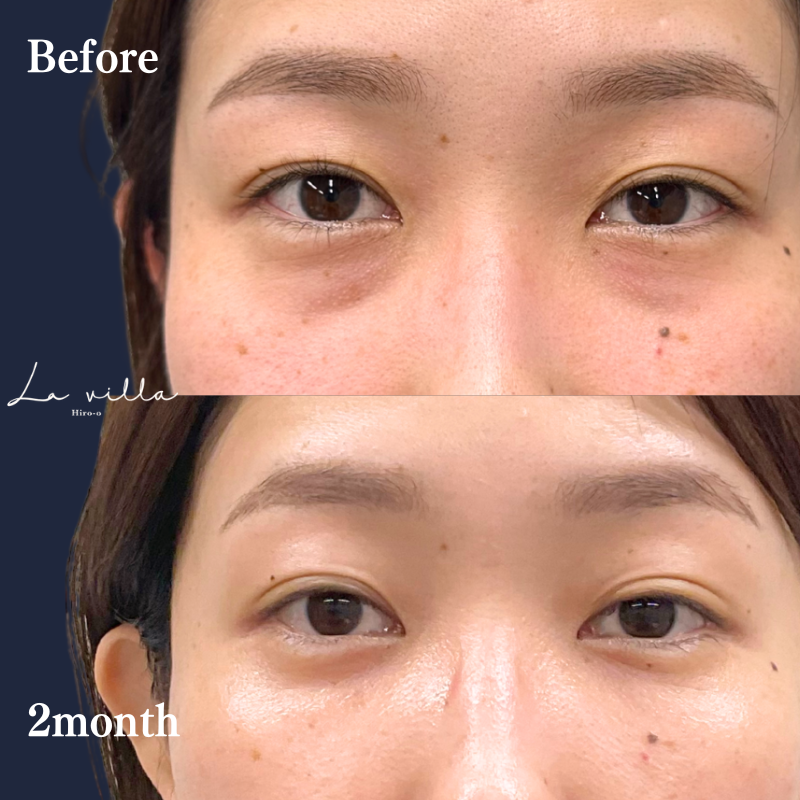 裏ハムラ　No.244