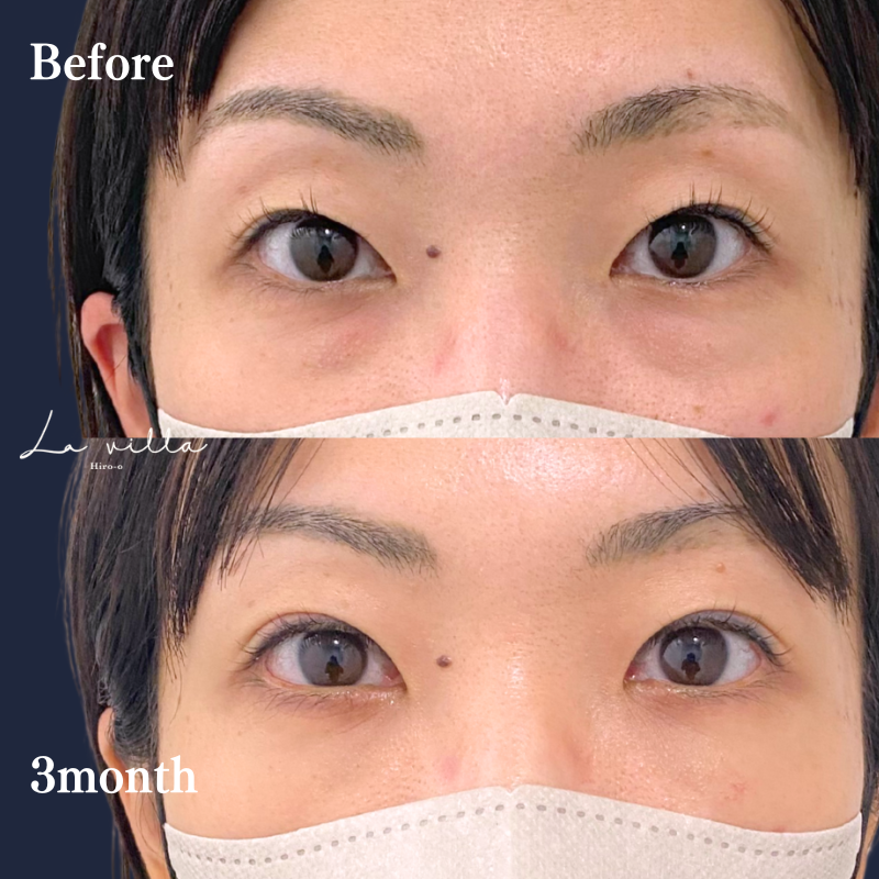 裏ハムラ　No.272