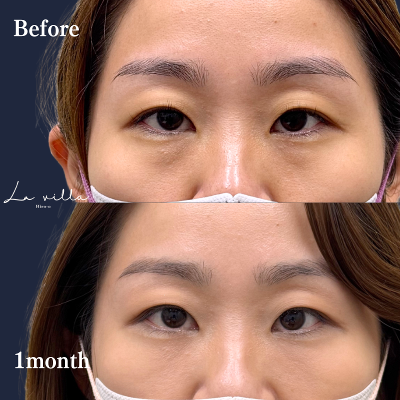 裏ハムラ　No.246