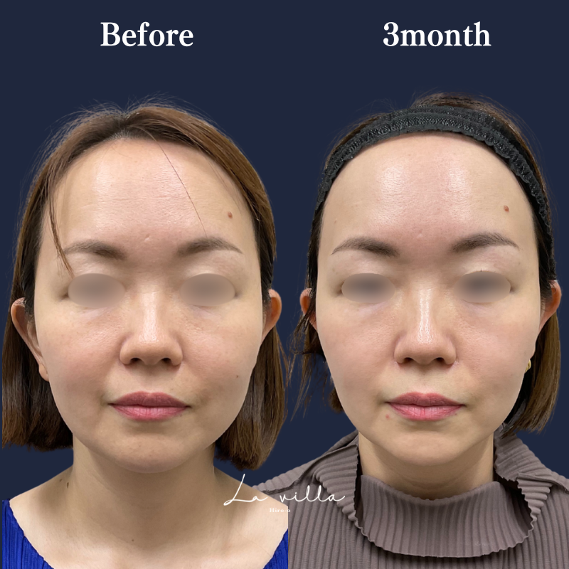 ボルニューマ×リヴァイブ No.249