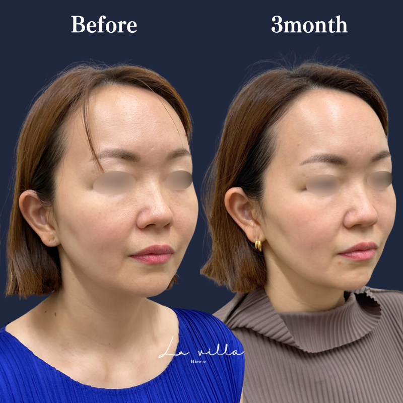 ボルニューマ×リヴァイブ No.249