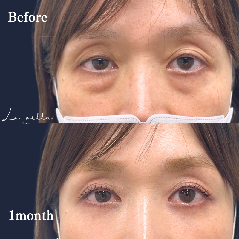 裏ハムラ　No.250