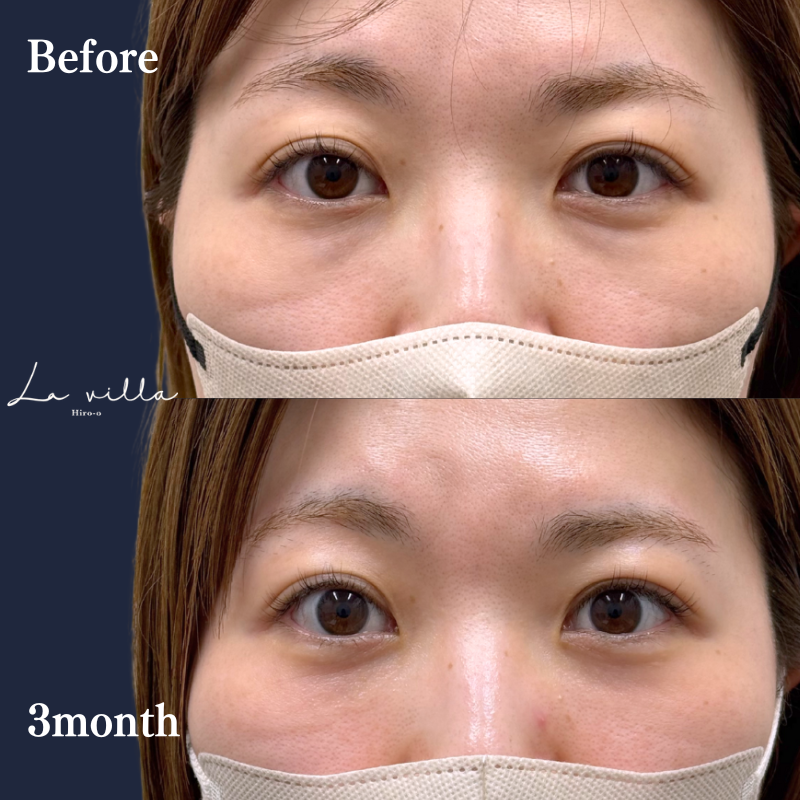 裏ハムラ　No.252