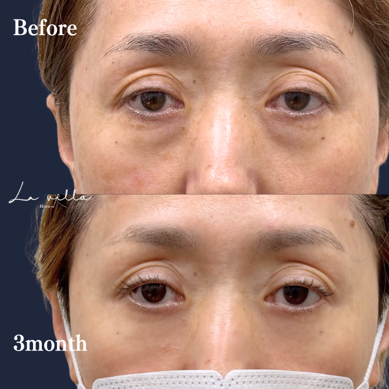 裏ハムラ　No.273