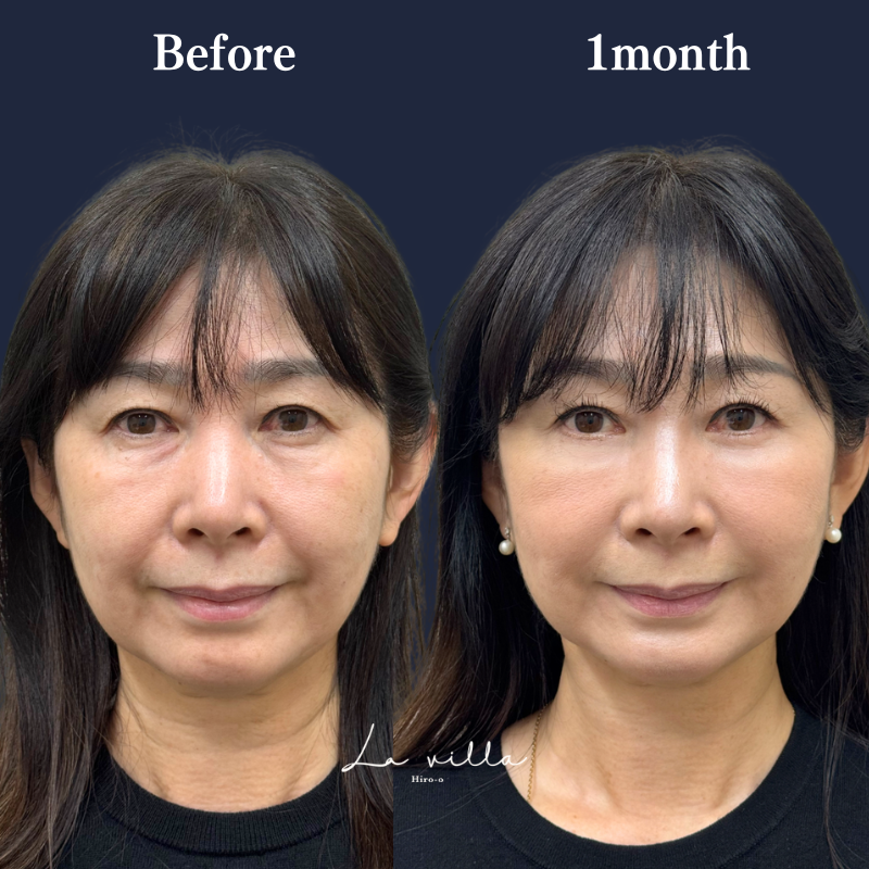 表ハムラ　No.253