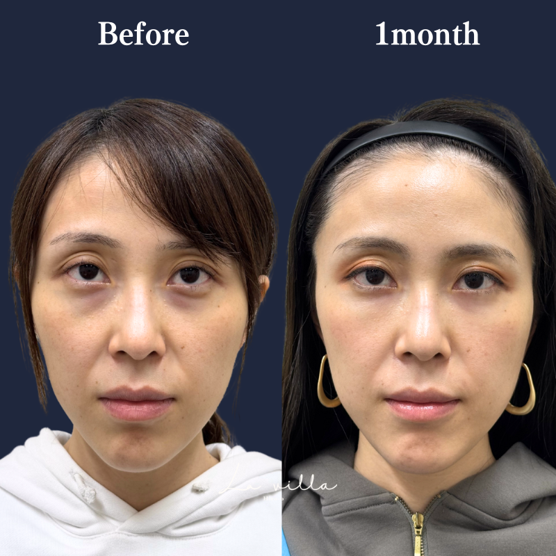 裏ハムラ　No.254