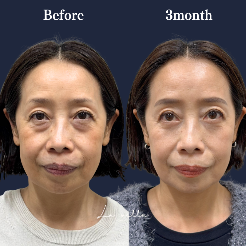 表ハムラ　No.255