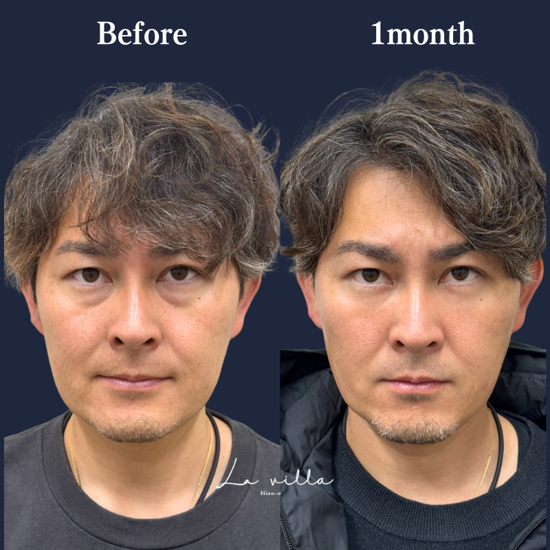 裏ハムラ　No.261