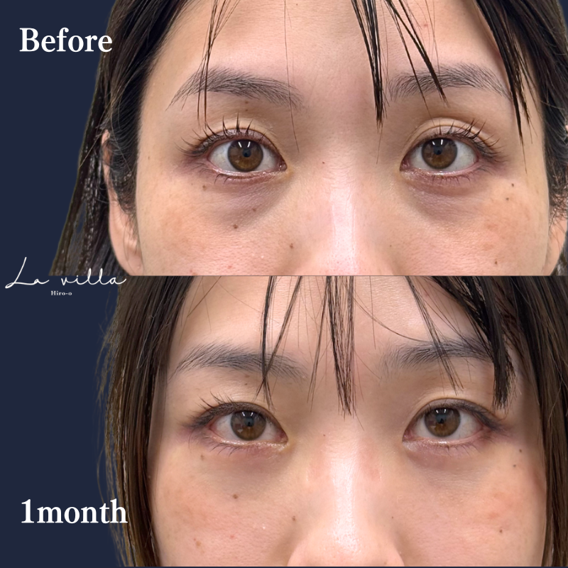 裏ハムラ　No.262