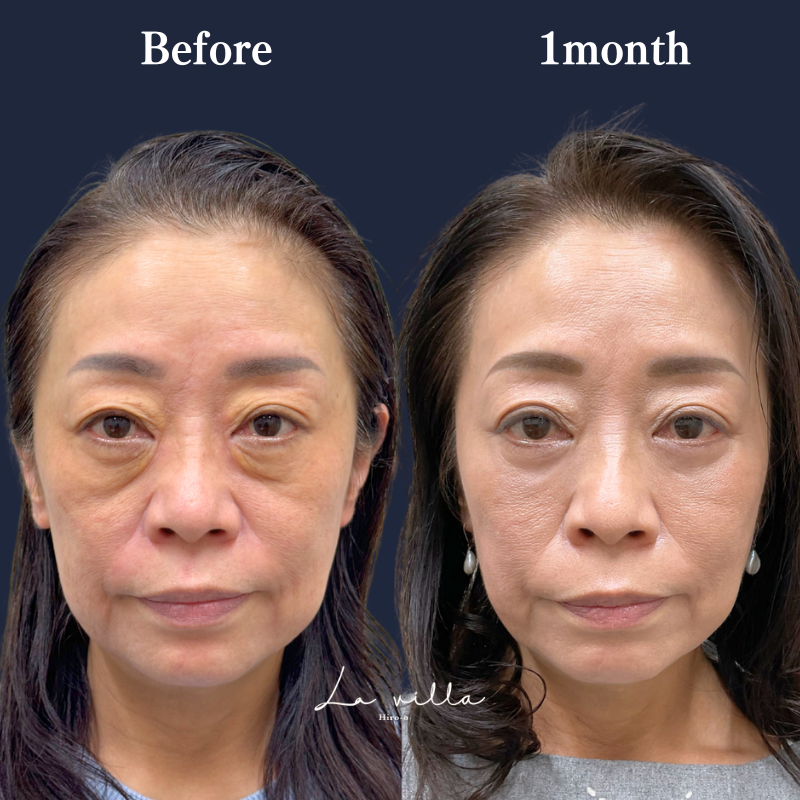 表ハムラ　No.263