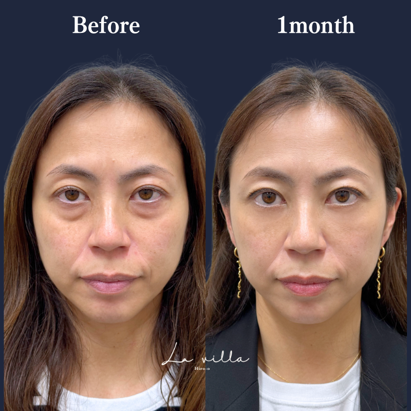 裏ハムラ　No.264