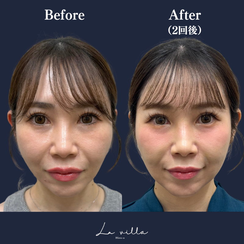 ジャルプロスーパーハイドロ No.269