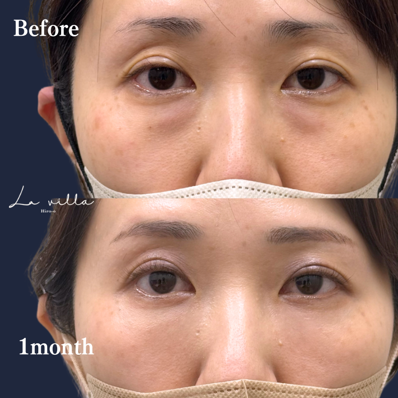 裏ハムラ　No.283