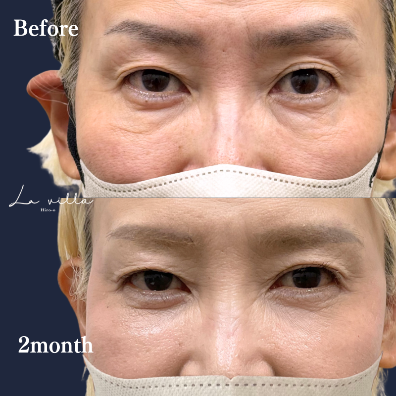 裏ハムラ　No.285