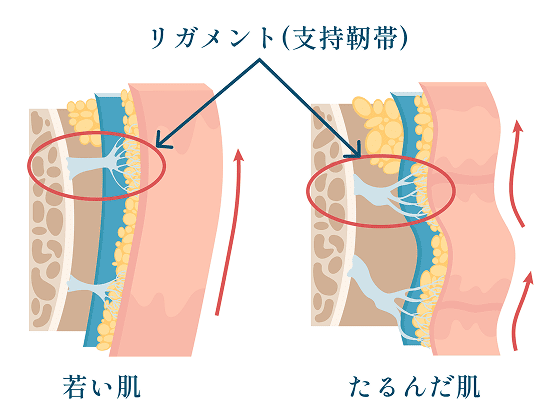 リガメント 若い肌とたるんだ肌の比較