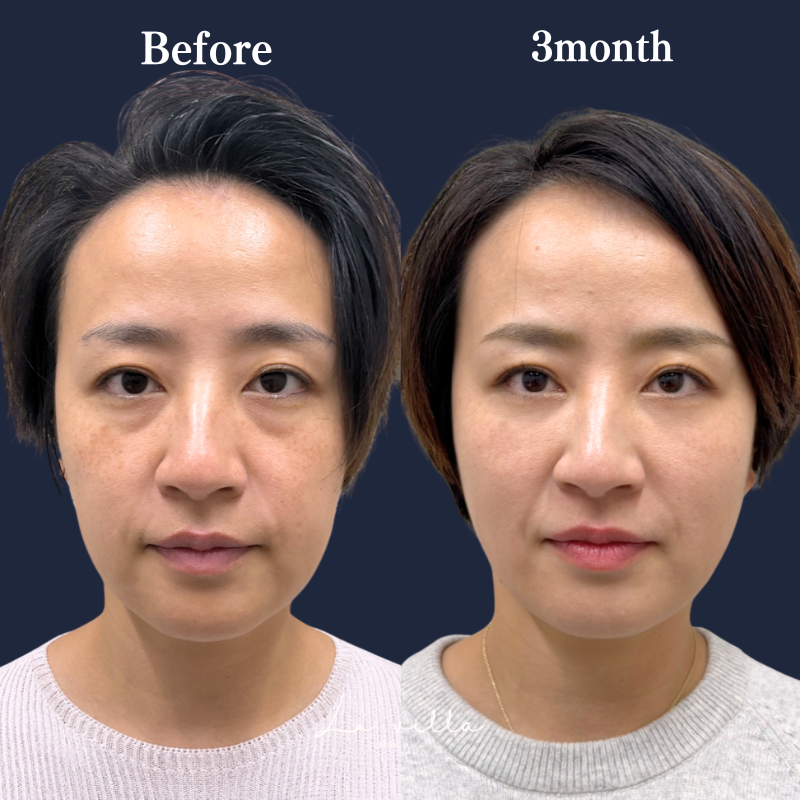 裏ハムラ　No.306