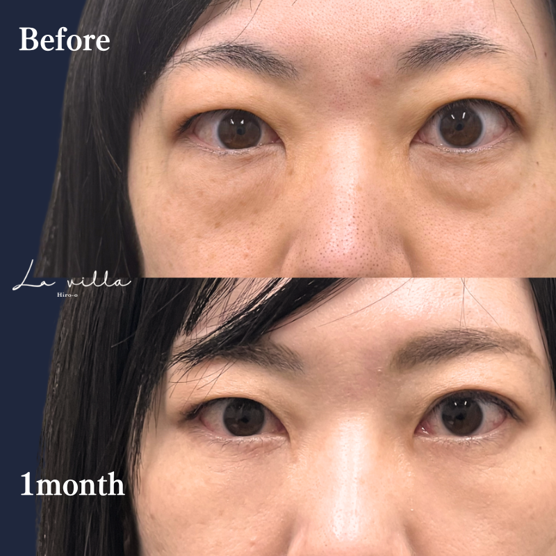 裏ハムラ　No.318