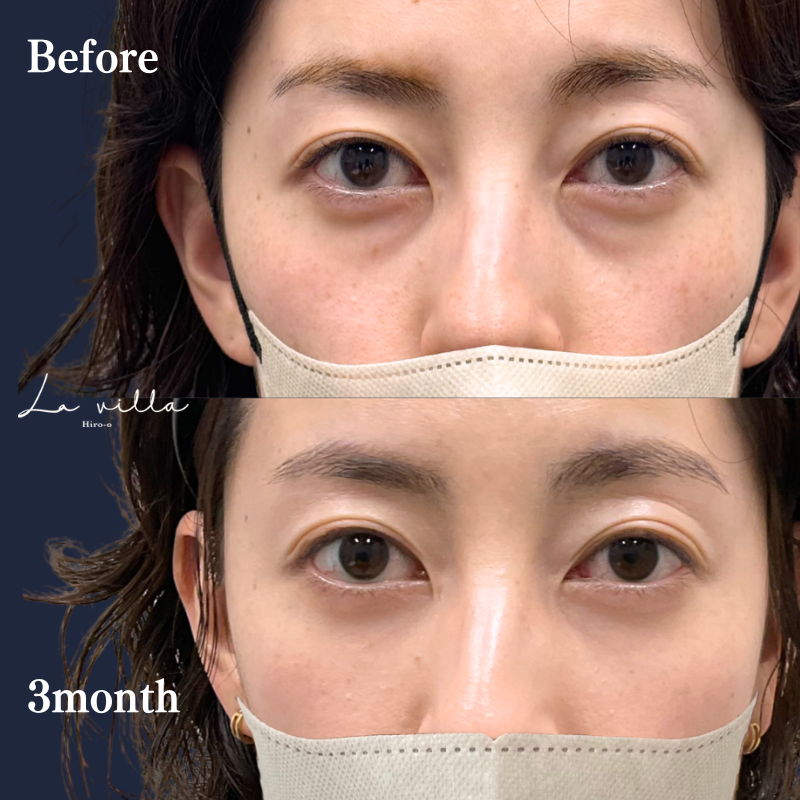 裏ハムラ　No.307