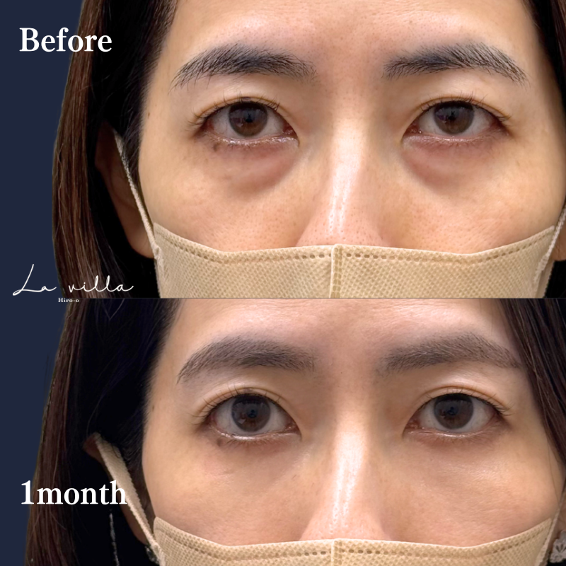 裏ハムラ　No.319