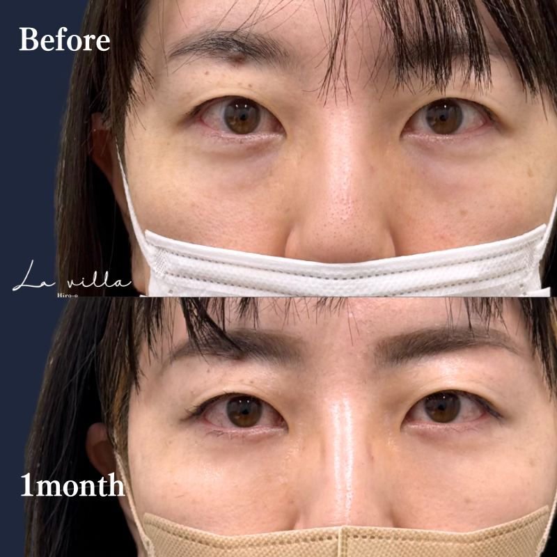 裏ハムラ　No.320