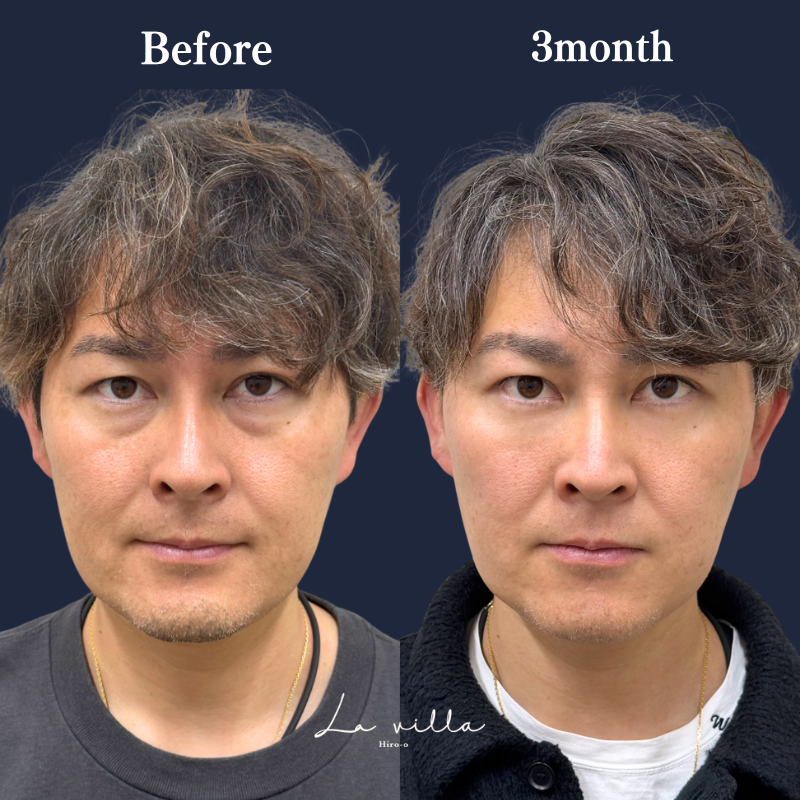 裏ハムラ　No.308