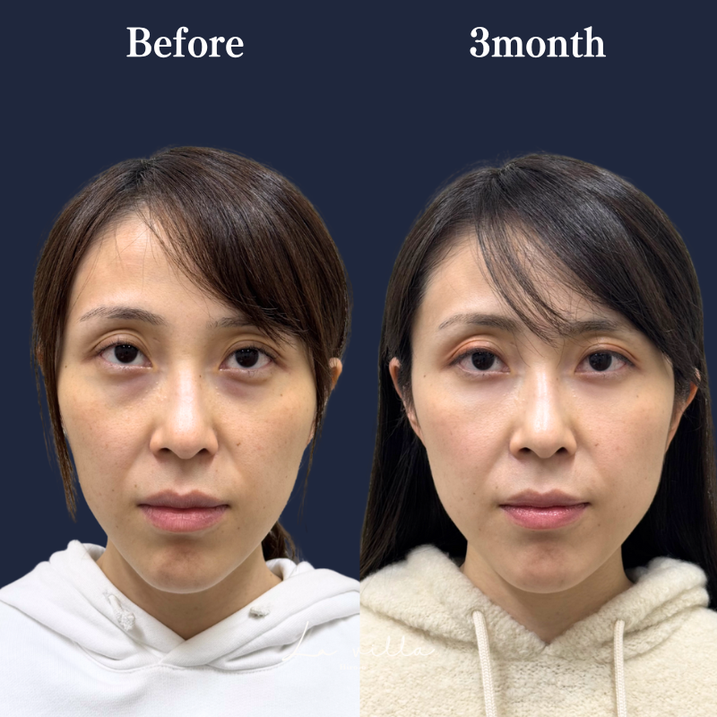 裏ハムラ　No.327