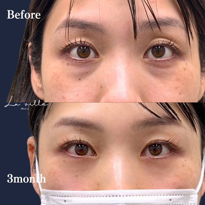 裏ハムラ　No.314