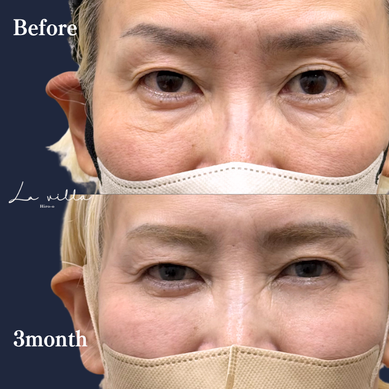 裏ハムラ　No.328