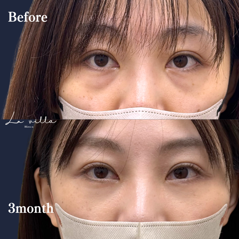 裏ハムラ　No.315