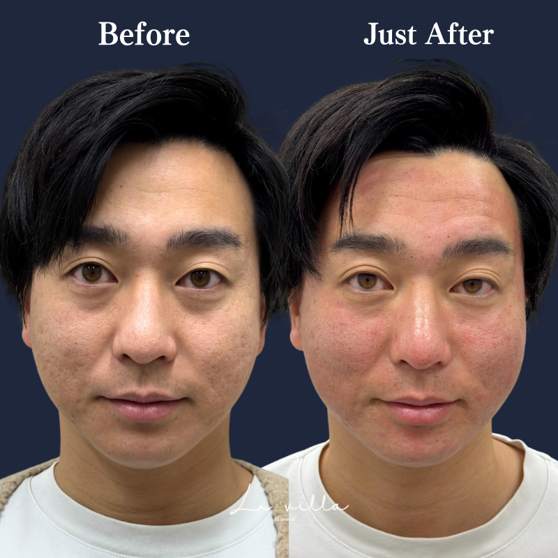 ブレッシング　No.329