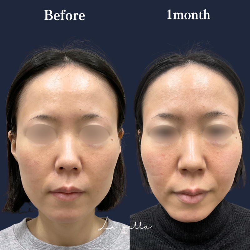 リヴァイブ　 No.294