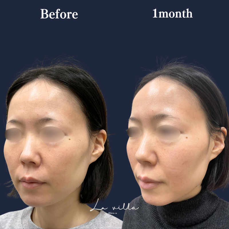 リヴァイブ　 No.294