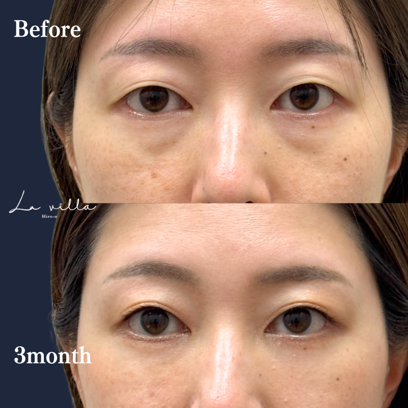 裏ハムラ　No.296