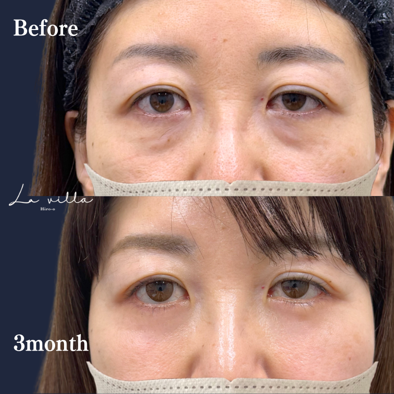 裏ハムラ　No.305